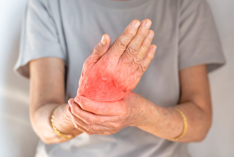 Can Rheumatoid Arthritis Be Reversed?